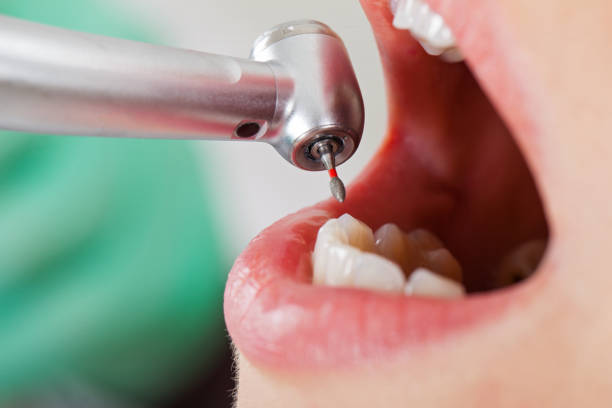 Best Emergency Dental Extractions in Brittany Farms The Highlands, PA